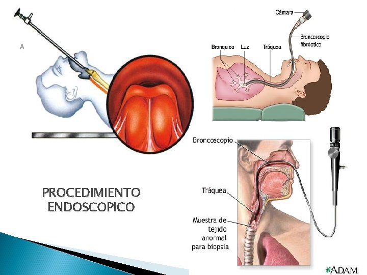 PROCEDIMIENTO ENDOSCOPICO 