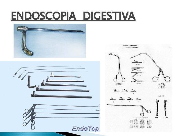 ENDOSCOPIA DIGESTIVA 