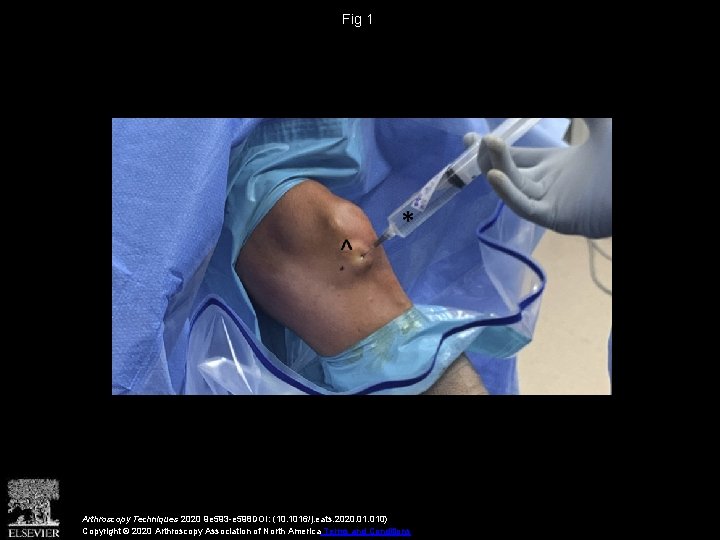 Fig 1 Arthroscopy Techniques 2020 9 e 593 -e 598 DOI: (10. 1016/j. eats.