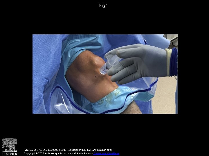 Fig 2 Arthroscopy Techniques 2020 9 e 593 -e 598 DOI: (10. 1016/j. eats.