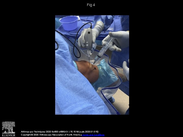 Fig 4 Arthroscopy Techniques 2020 9 e 593 -e 598 DOI: (10. 1016/j. eats.