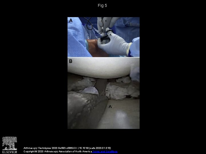 Fig 5 Arthroscopy Techniques 2020 9 e 593 -e 598 DOI: (10. 1016/j. eats.