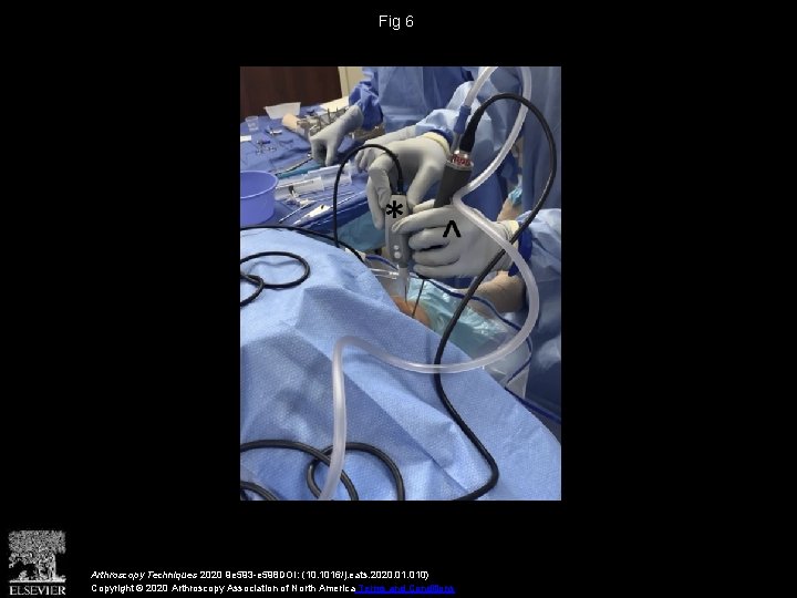 Fig 6 Arthroscopy Techniques 2020 9 e 593 -e 598 DOI: (10. 1016/j. eats.