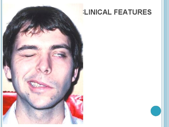 CLINICAL FEATURES 