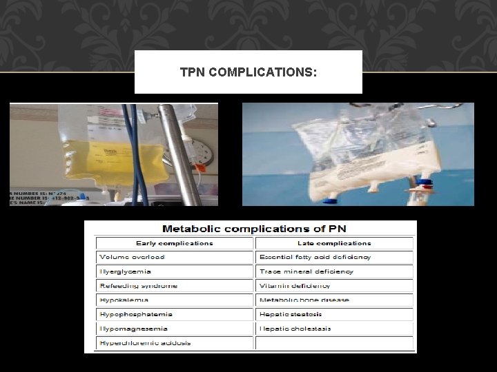 TPN COMPLICATIONS: 