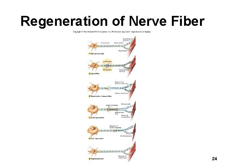 Regeneration of Nerve Fiber 24 