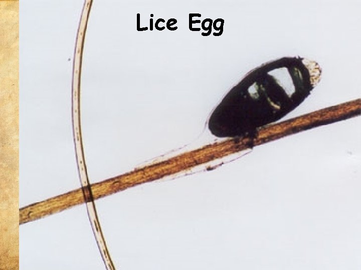 Lice Egg 