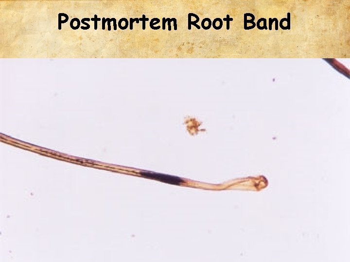 Postmortem Root Band 