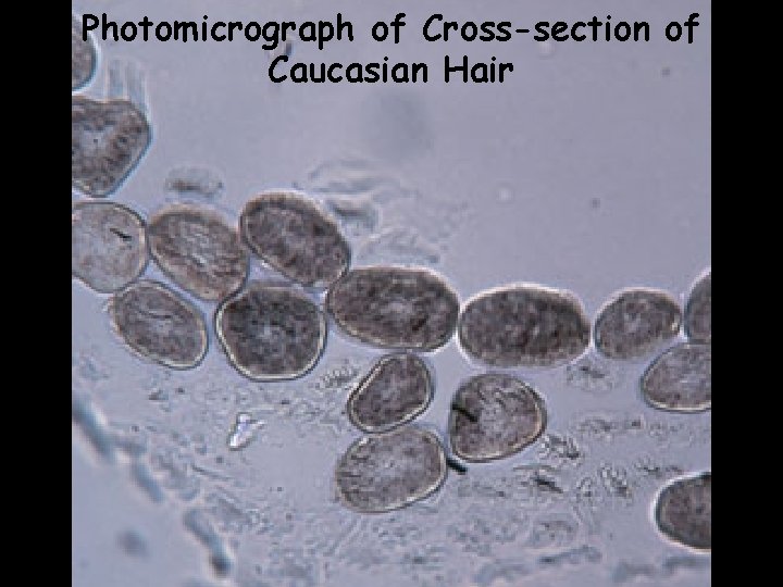 Photomicrograph of Cross-section of Caucasian Hair 