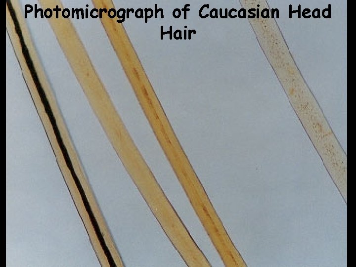 Photomicrograph of Caucasian Head Hair 