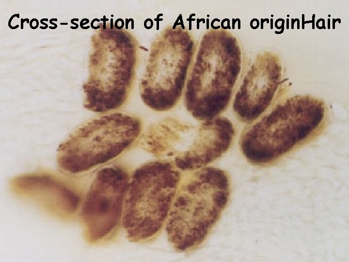 Cross-section of African origin. Hair 