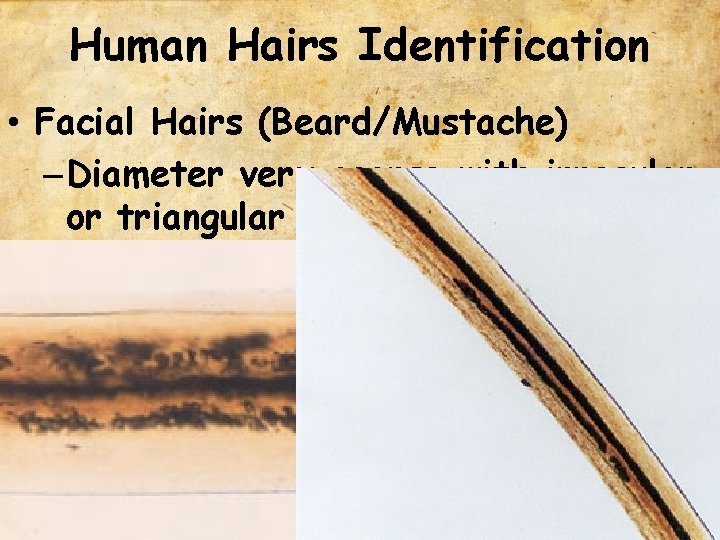 Human Hairs Identification • Facial Hairs (Beard/Mustache) – Diameter very coarse with irregular or