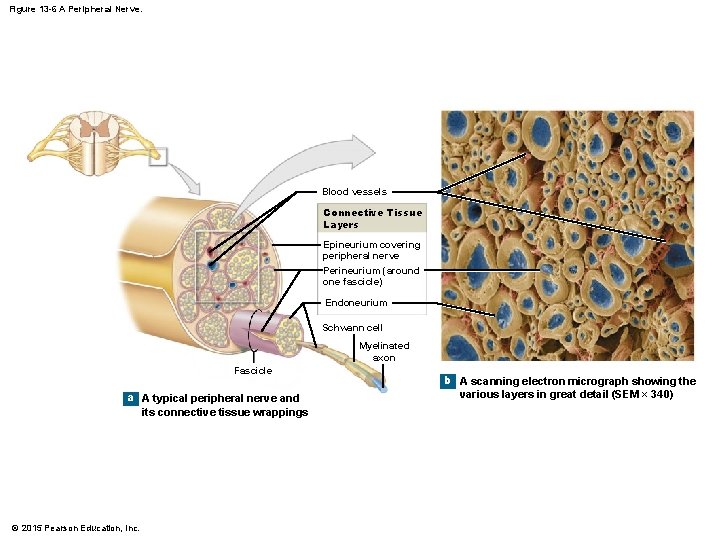 Figure 13 -6 A Peripheral Nerve. Blood vessels Connective Tissue Layers Epineurium covering peripheral