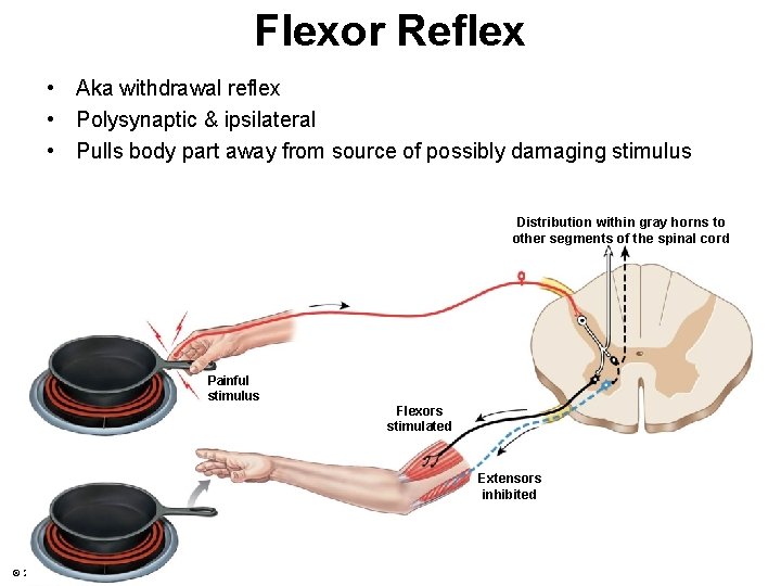 Flexor Reflex • Aka withdrawal reflex • Polysynaptic & ipsilateral • Pulls body part