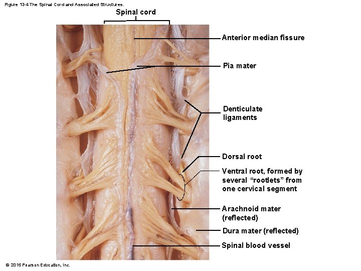 Figure 13 -4 The Spinal Cord and Associated Structures. Spinal cord Anterior median fissure