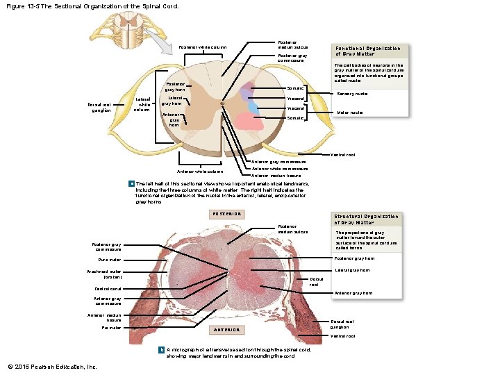 Figure 13 -5 The Sectional Organization of the Spinal Cord. Posterior white column Posterior