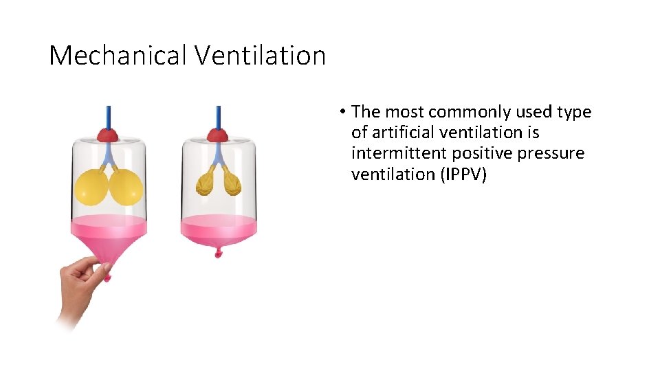 Mechanical Ventilation • The most commonly used type of artificial ventilation is intermittent positive