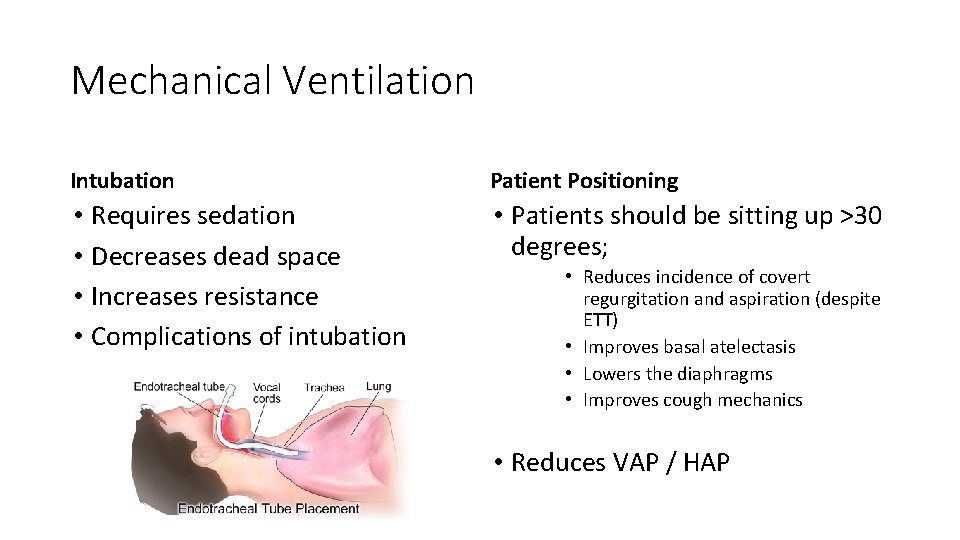 Mechanical Ventilation Intubation Patient Positioning • Requires sedation • Decreases dead space • Increases