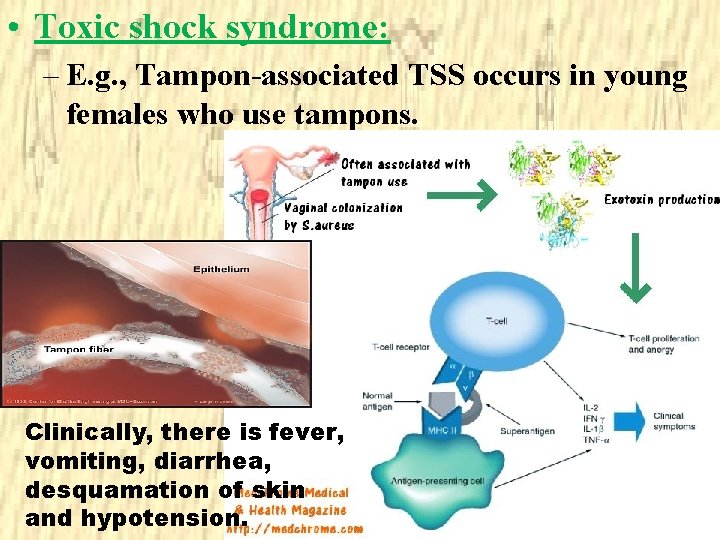  • Toxic shock syndrome: – E. g. , Tampon-associated TSS occurs in young