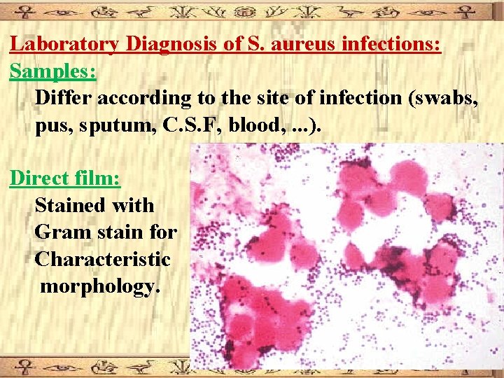 Laboratory Diagnosis of S. aureus infections: Samples: Differ according to the site of infection