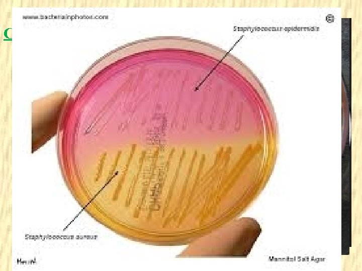 Culture – facultative anaerobes, optimum temperature: 37 C, normal atmospheric CO 2 – Can