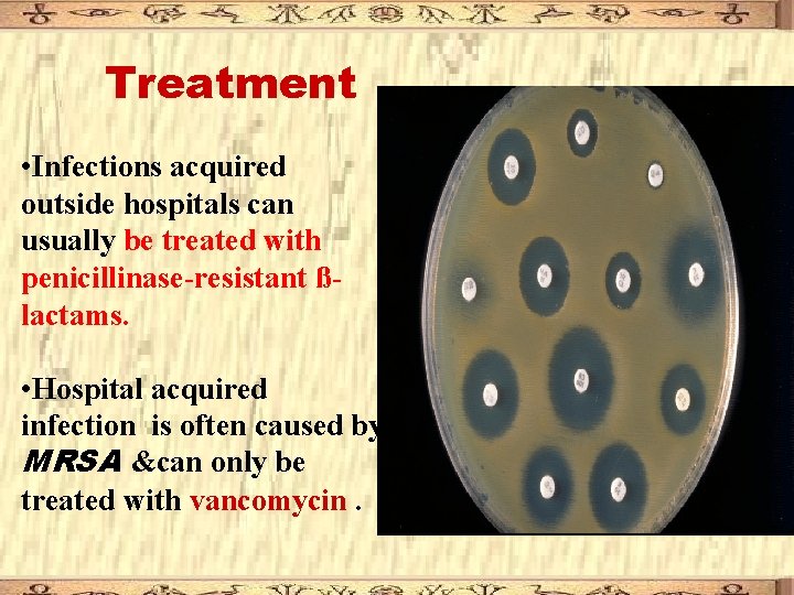 Treatment • Infections acquired outside hospitals can usually be treated with penicillinase-resistant ßlactams. • Treatment • Infections acquired outside hospitals can usually be treated with penicillinase-resistant ßlactams. •
