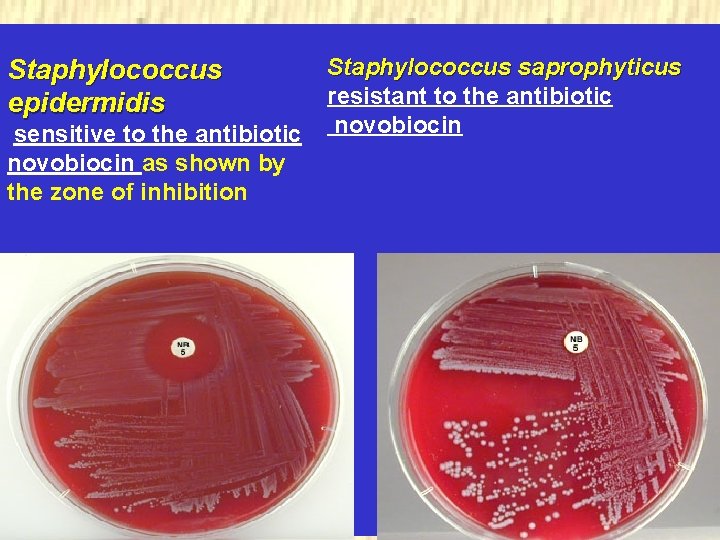 Staphylococcus epidermidis sensitive to the antibiotic novobiocin as shown by the zone of inhibition Staphylococcus epidermidis sensitive to the antibiotic novobiocin as shown by the zone of inhibition