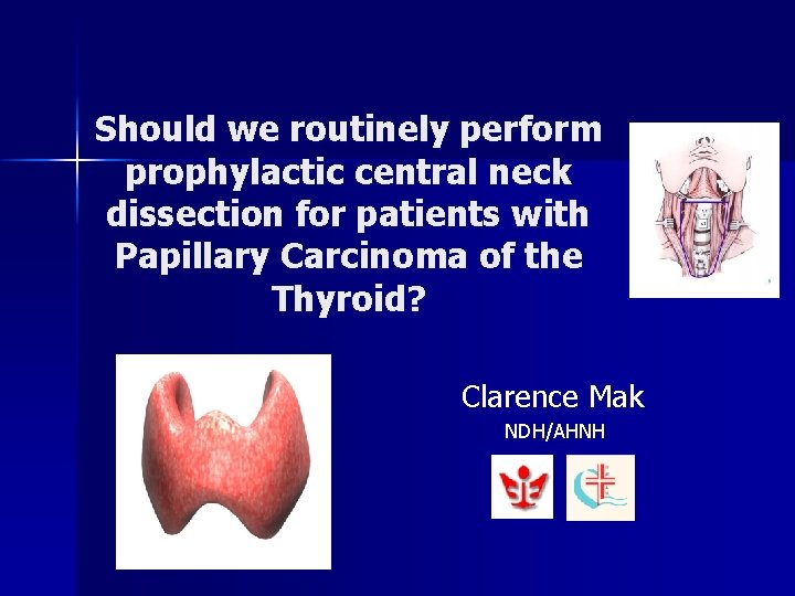Should we routinely perform prophylactic central neck dissection for patients with Papillary Carcinoma of Should we routinely perform prophylactic central neck dissection for patients with Papillary Carcinoma of