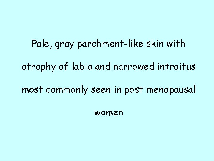 Pale, gray parchment-like skin with atrophy of labia and narrowed introitus most commonly seen