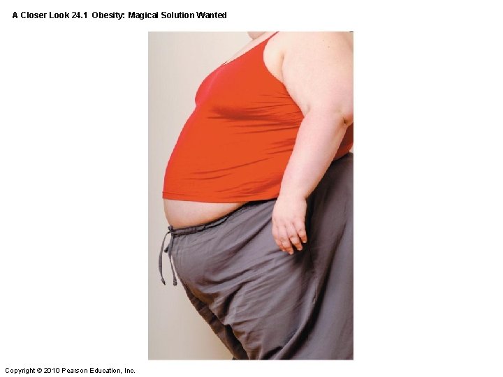 A Closer Look 24. 1 Obesity: Magical Solution Wanted Copyright © 2010 Pearson Education,