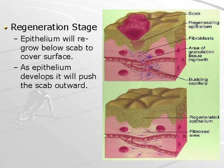 Regeneration Stage – Epithelium will regrow below scab to cover surface. – As epithelium