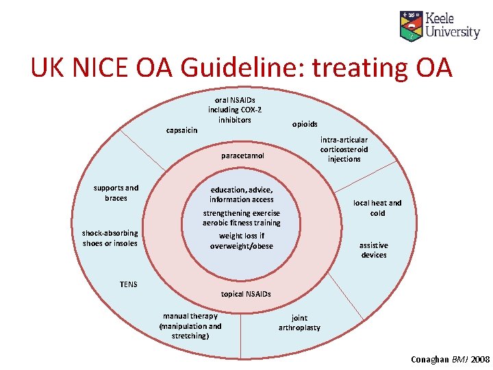 UK NICE OA Guideline: treating OA oral NSAIDs including COX-2 inhibitors opioids capsaicin intra-articular