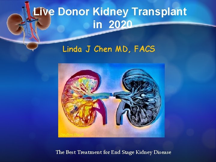 Live Donor Kidney Transplant in 2020 Linda J Chen MD, FACS Daulton Shaull The