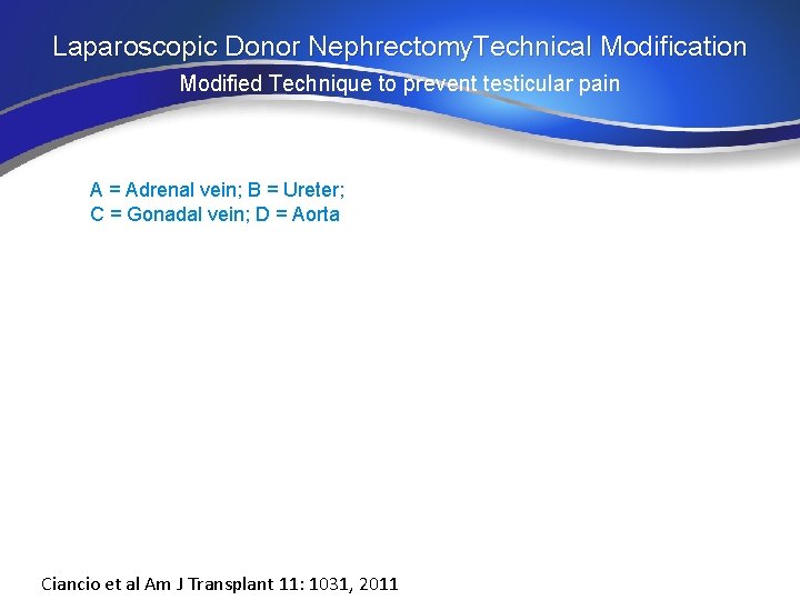 Laparoscopic Donor Nephrectomy. Technical Modification Modified Technique to prevent testicular pain A = Adrenal