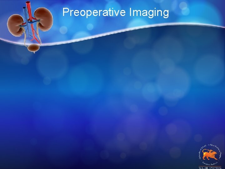 Preoperative Imaging 