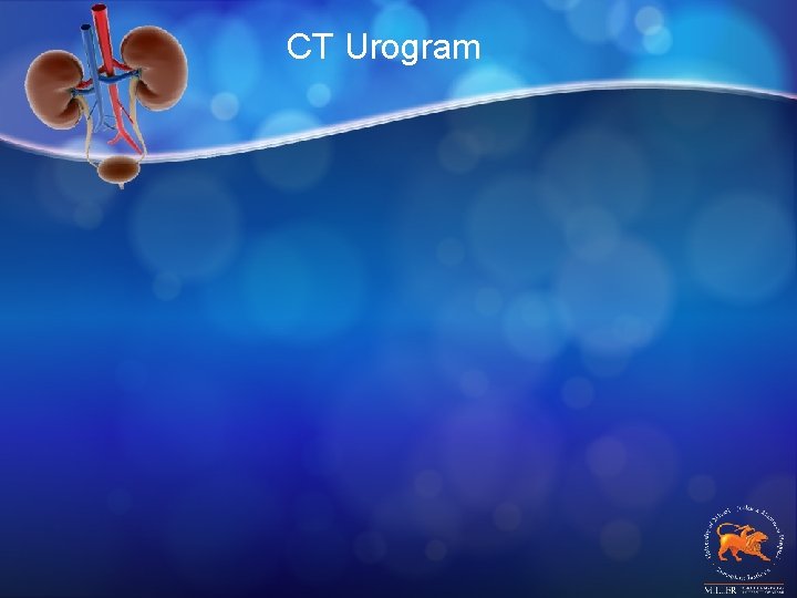CT Urogram 