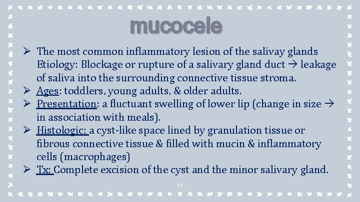 mucocele Ø The most common inflammatory lesion of the salivay glands Etiology: Blockage or