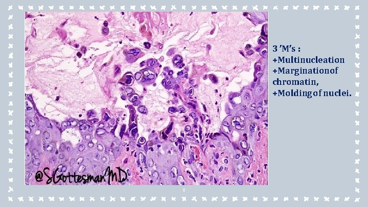 3 ’M’s : +Multinucleation +Marginationof chromatin, +Molding of nuclei. 8 