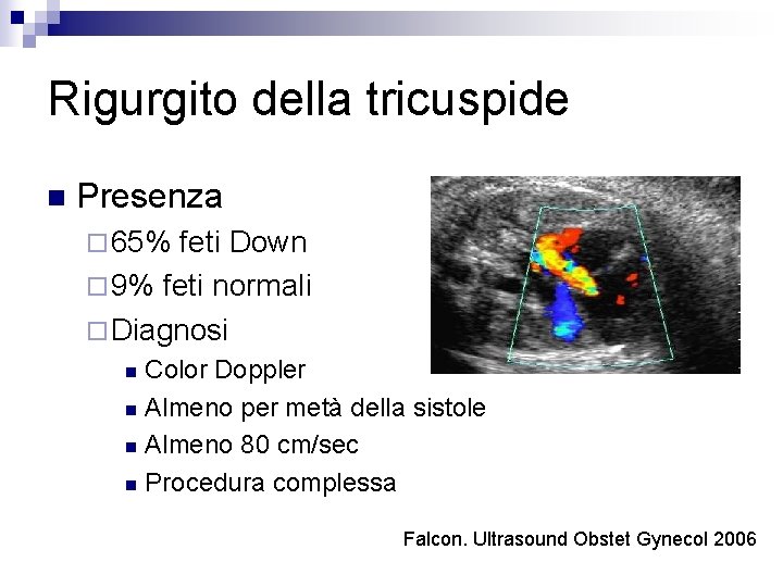 Rigurgito della tricuspide n Presenza ¨ 65% feti Down ¨ 9% feti normali ¨