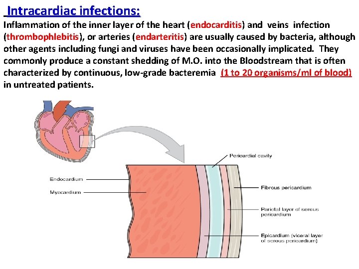 Intracardiac infections: Inflammation of the inner layer of the heart (endocarditis) and veins infection