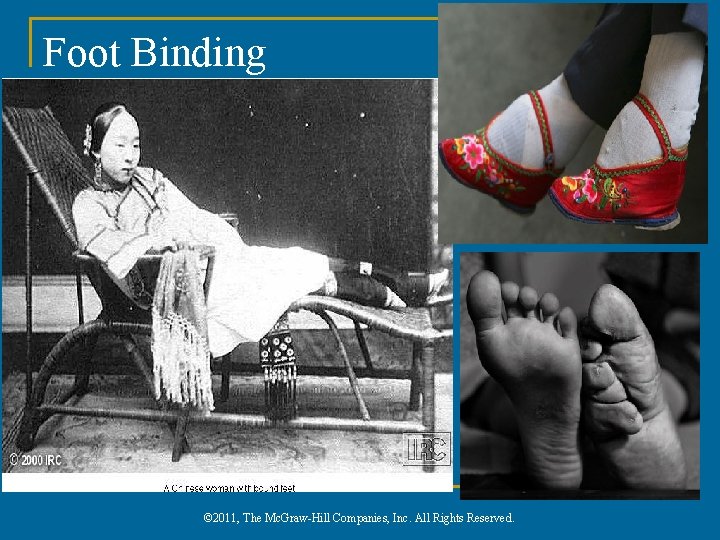 Foot Binding © 2011, The Mc. Graw-Hill Companies, Inc. All Rights Reserved. 