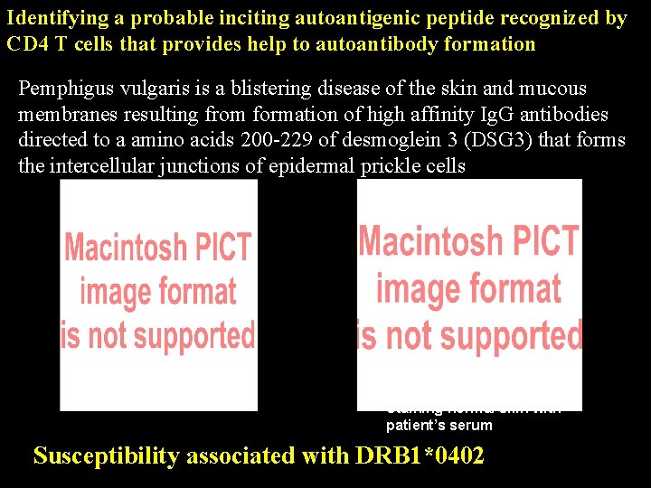 Identifying a probable inciting autoantigenic peptide recognized by CD 4 T cells that provides