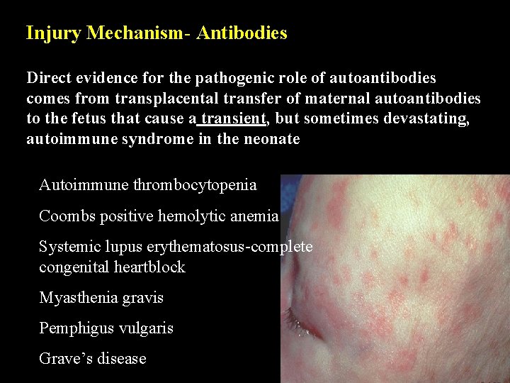 Injury Mechanism- Antibodies Direct evidence for the pathogenic role of autoantibodies comes from transplacental