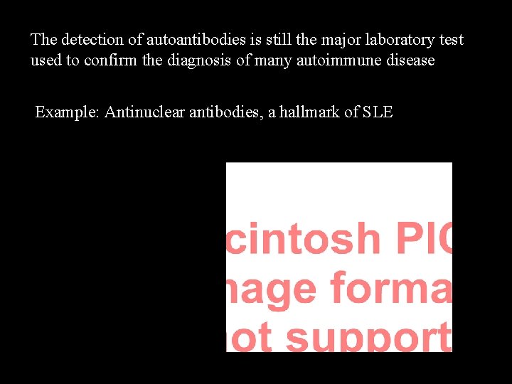 The detection of autoantibodies is still the major laboratory test used to confirm the