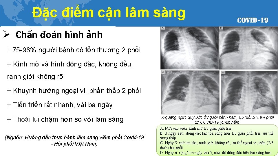 Đặc điểm cận lâm sàng Ø Chẩn đoán hình ảnh + 75 -98% người