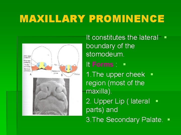 MAXILLARY PROMINENCE It constitutes the lateral § boundary of the stomodeum. It Forms :