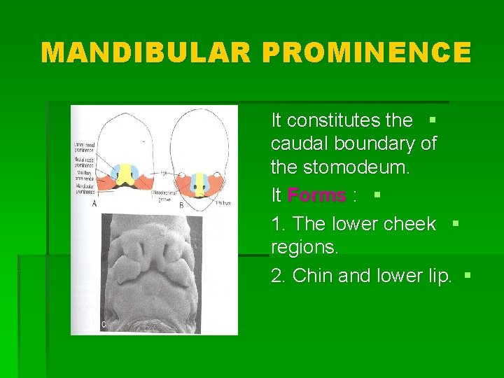 MANDIBULAR PROMINENCE It constitutes the § caudal boundary of the stomodeum. It Forms :