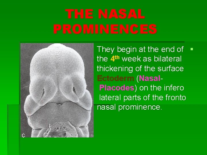 THE NASAL PROMINENCES They begin at the end of § the 4 th week