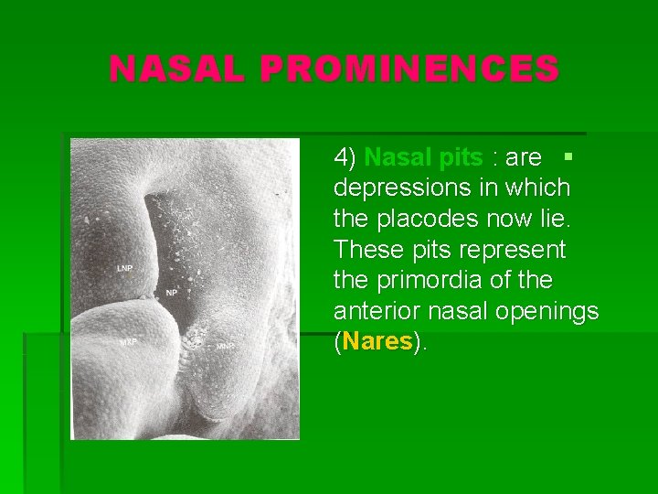 NASAL PROMINENCES 4) Nasal pits : are § depressions in which the placodes now