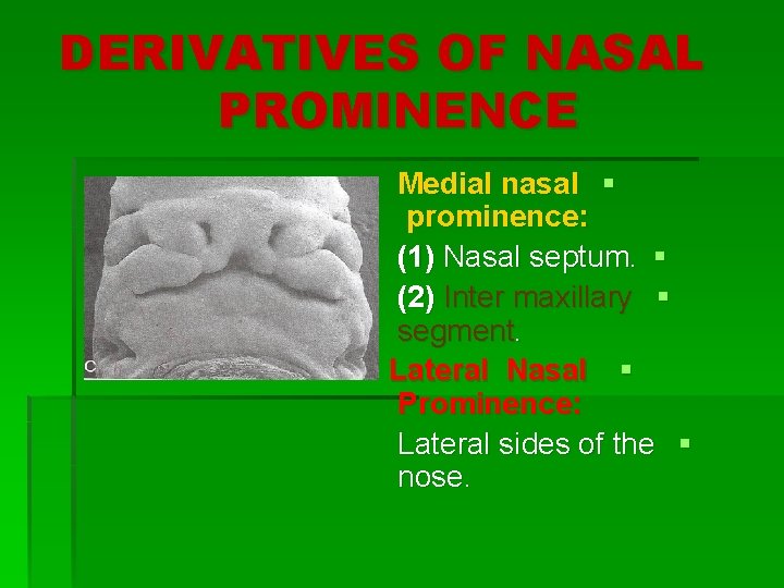 DERIVATIVES OF NASAL PROMINENCE Medial nasal § prominence: (1) Nasal septum. § (2) Inter